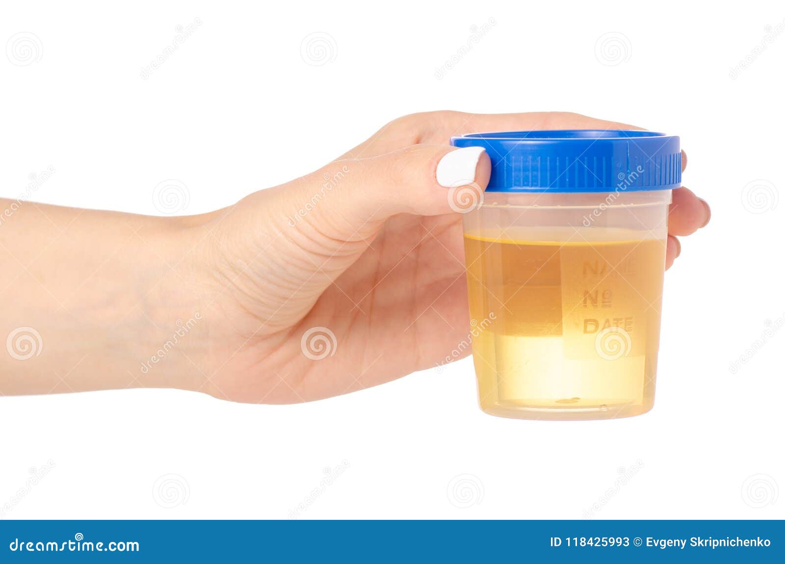 Plastic Container with Urine in Hand Analysis Stock Image Image of