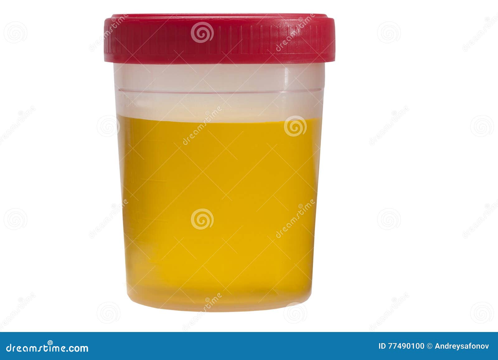 Plastic Jar with Urine Tests Isolated on White Background Stock Photo