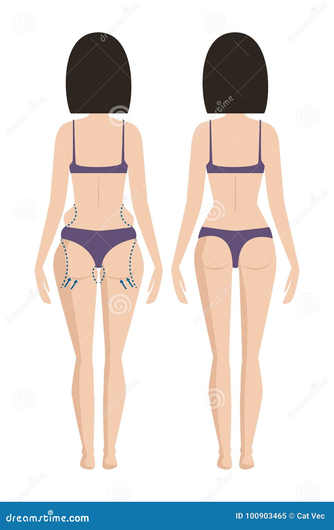 Plastic Surgery Body Parts Woman Correction Anaplasty Medicine Skin Treatment Beauty Health Procedure Vector Illustration 100903465 Megapixl