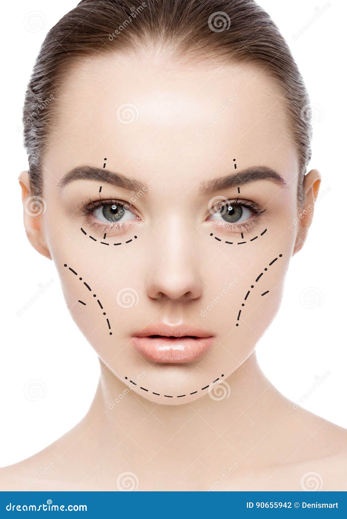 Plastic Surgery Woman Face With Face Lift Lines Stock Photo Image Of Care Head