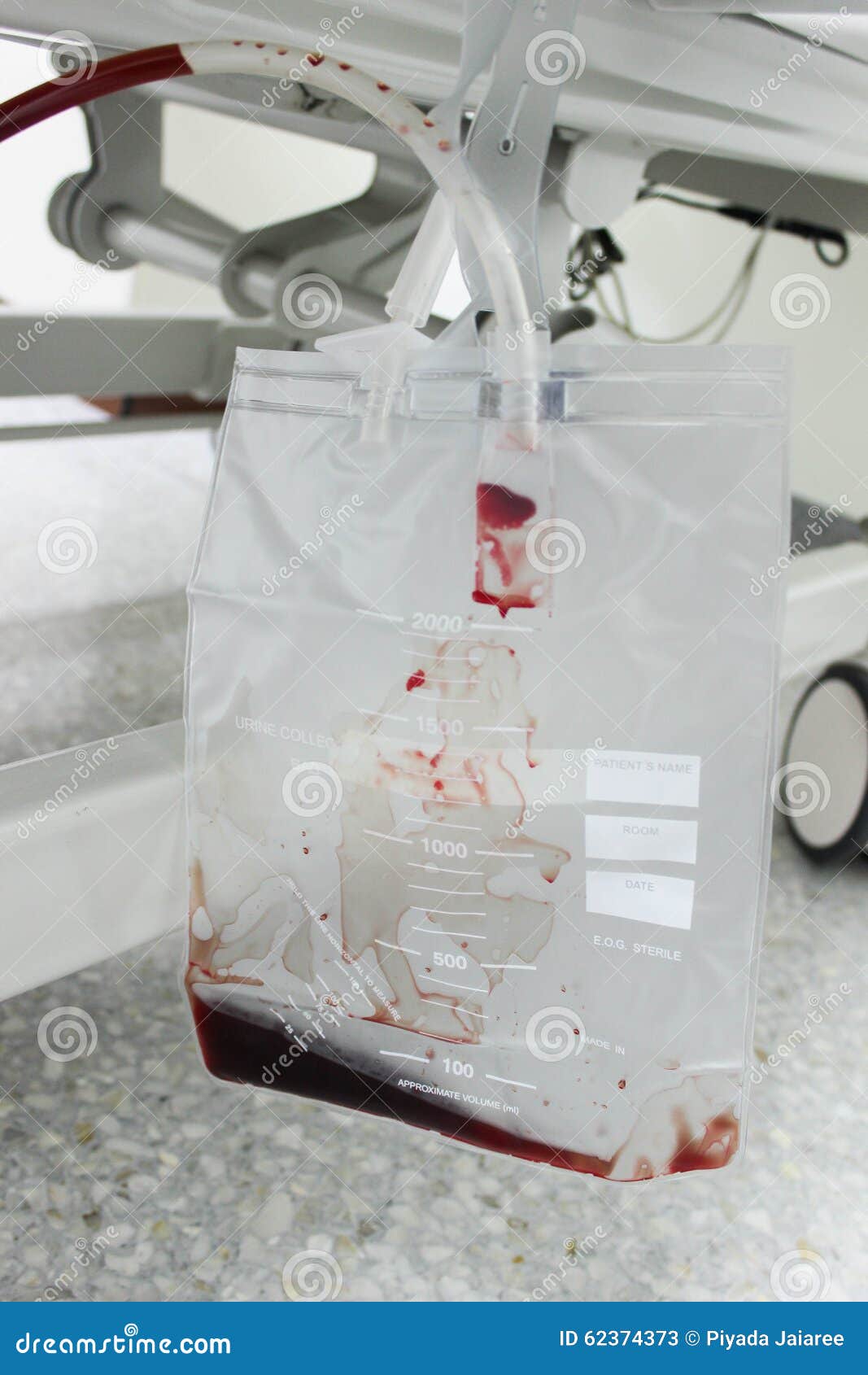 A plastic urine bag. stock image. Image of blood, hospital 62374373