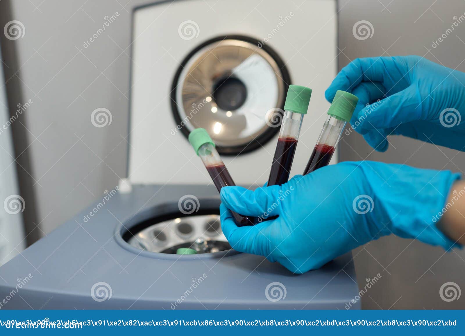 PlateletRich Plasma Preparation. Plasma in Syringe. Centrifuge. Stock Photo Image of