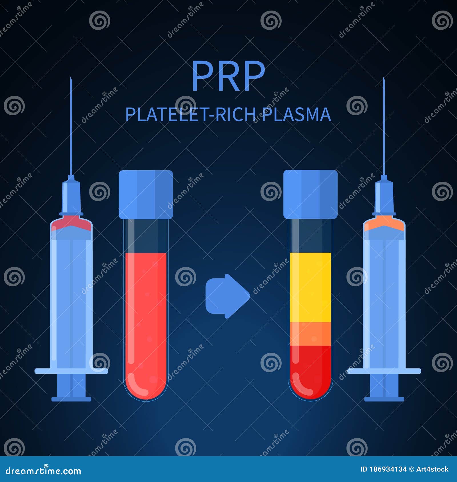 platelet rich plasma therapy procedure infographics poster