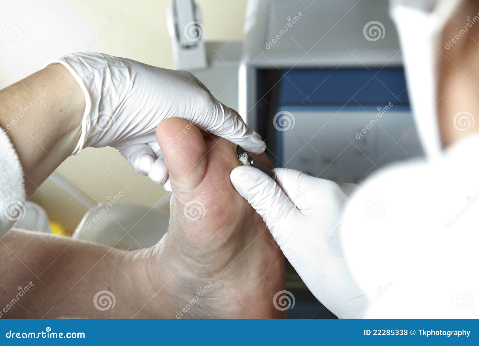 A Podiatrist Works with a Scalpel Stock Photo - Image of barefoot, pedicure:  22285338