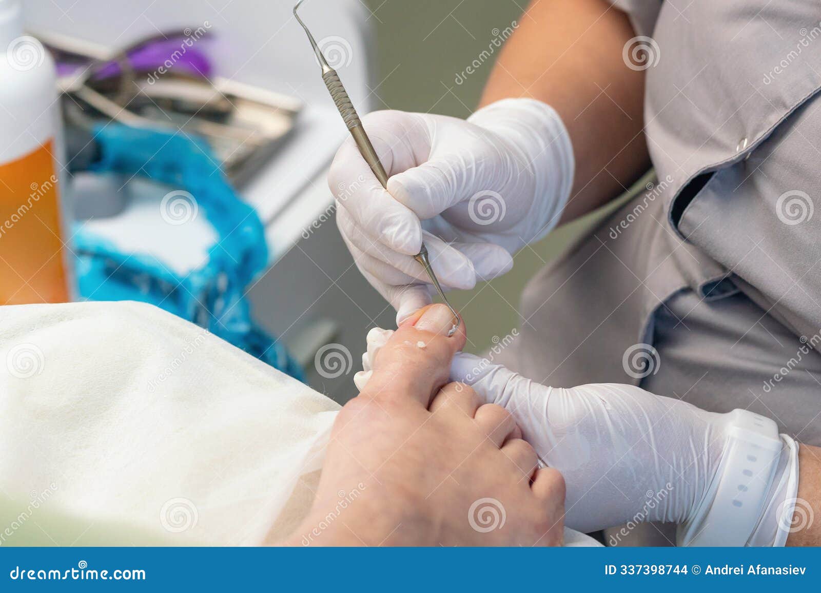podologist uses a curette to remove a callus on the toe