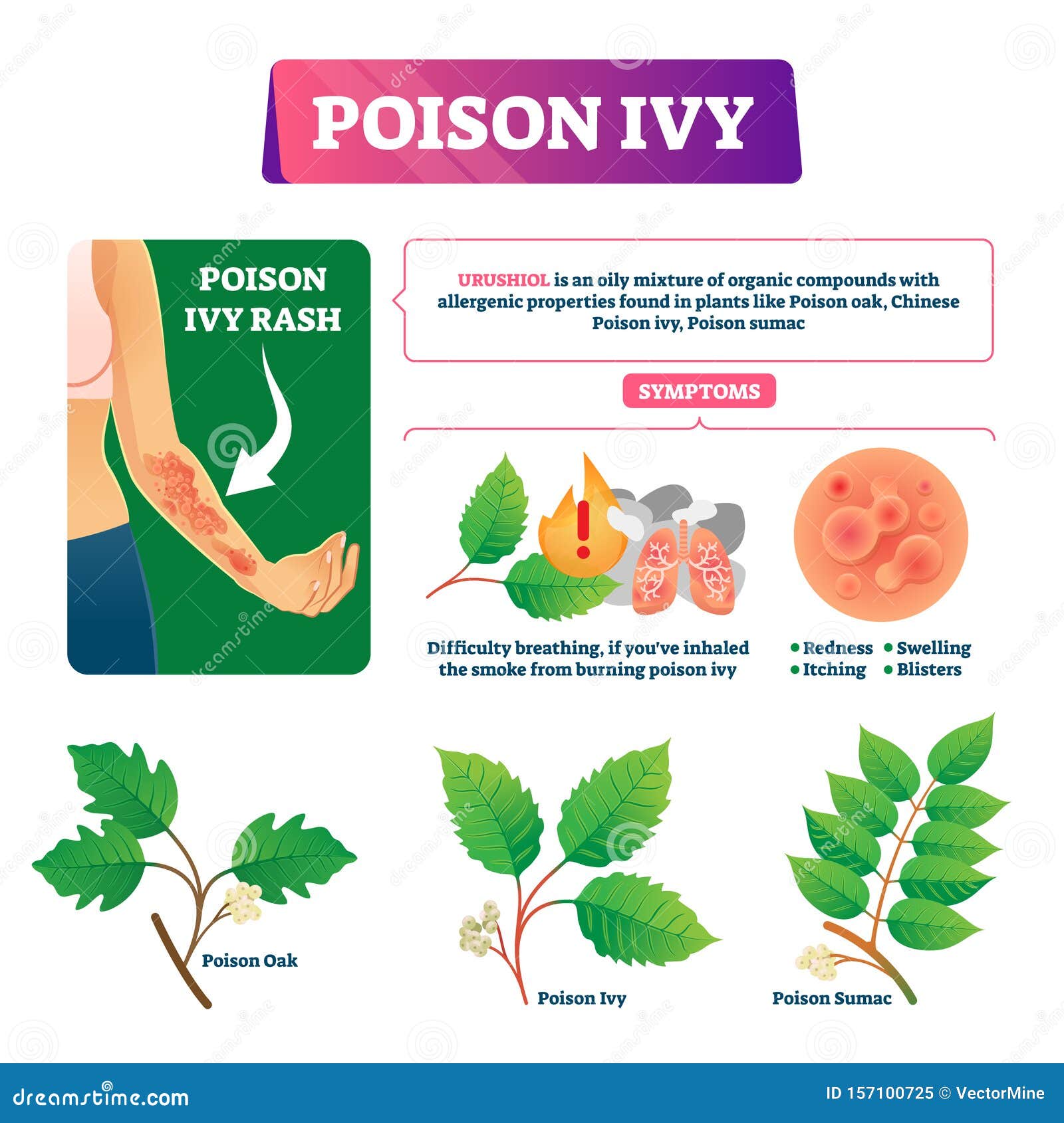 Poison Ivy Vector Illustration. Educational Dangerous Urushoil Plant ...