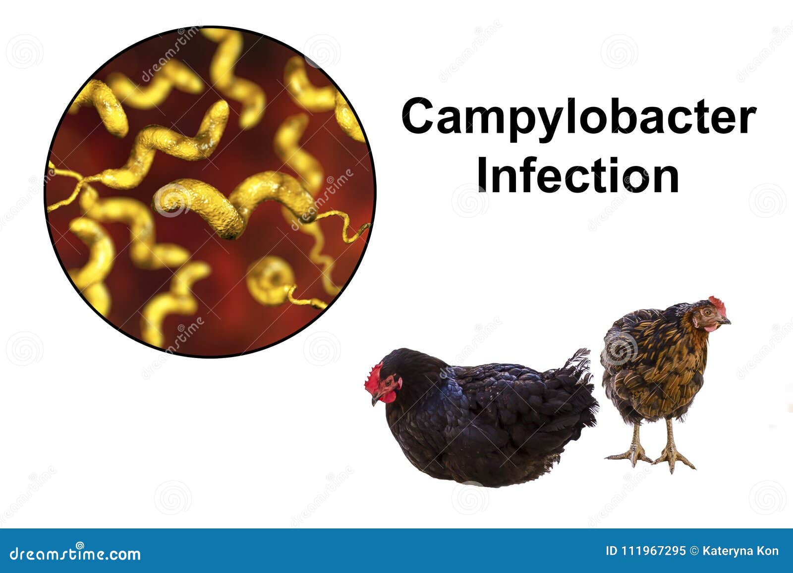 Pollo Como La Fuente De Infección Del Campylobacter Imagen de archivo -  Imagen de medicina, alimento: 111967295