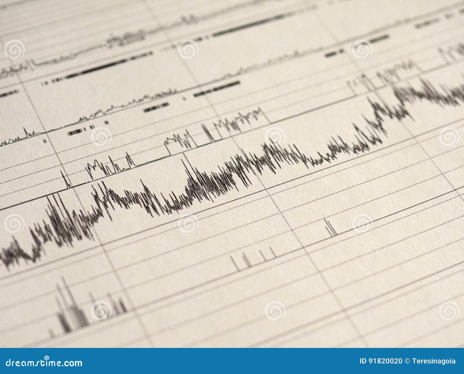 Sleep Study Chart