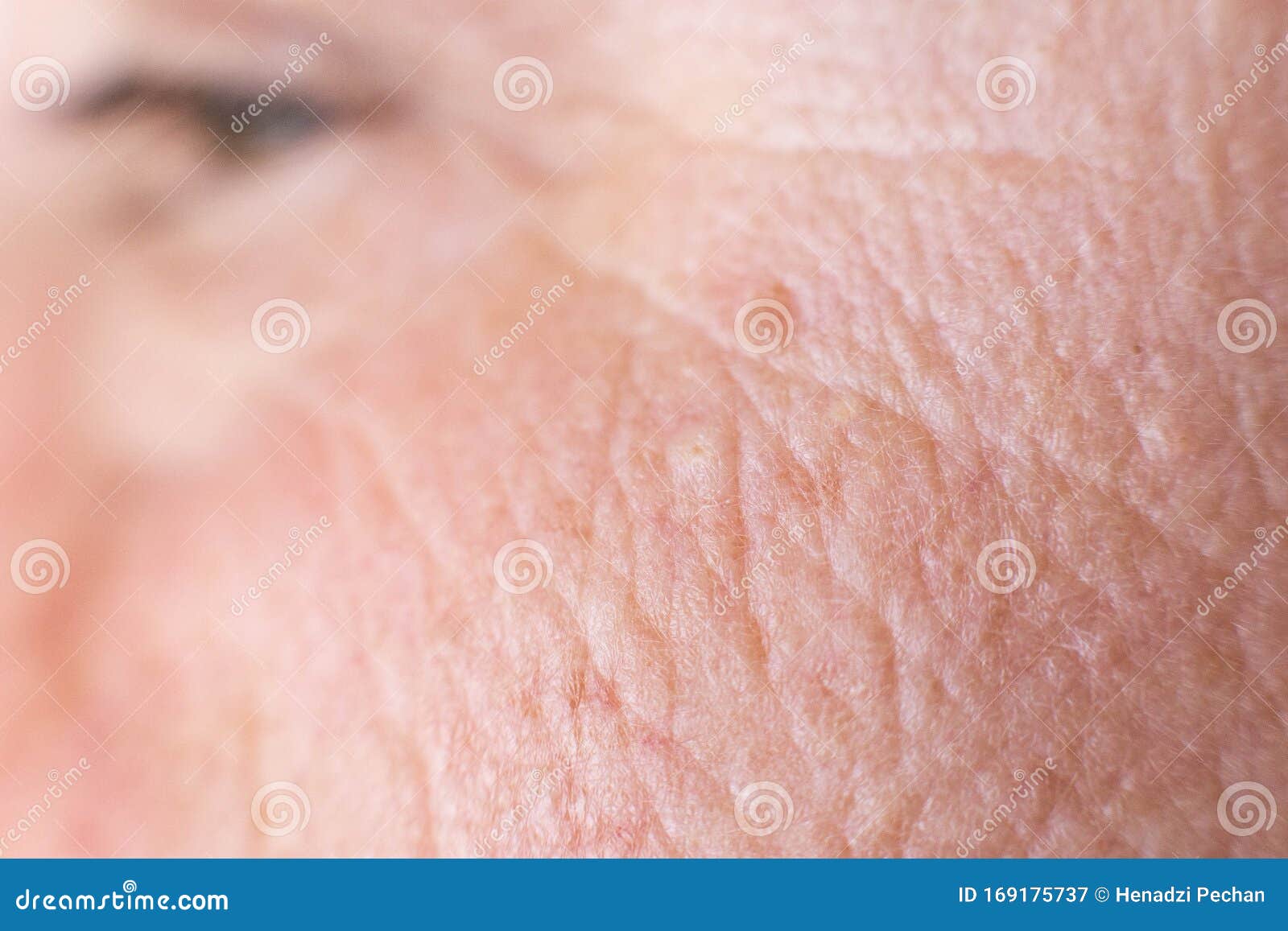 2,827,483 Fotos de Stock de Skin Face - Fotos de Stock Gratuitas e Sem Fidelização a partir da Dreamstime imagem