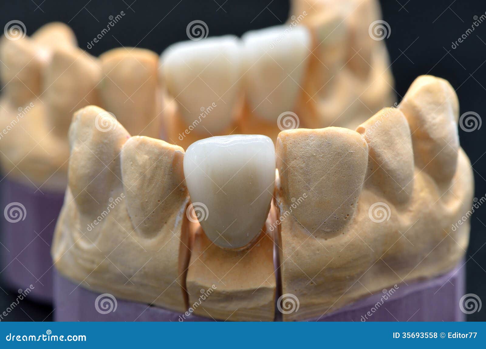 Porcelain Teeth on Dentures Models Stock Photo Image of dental