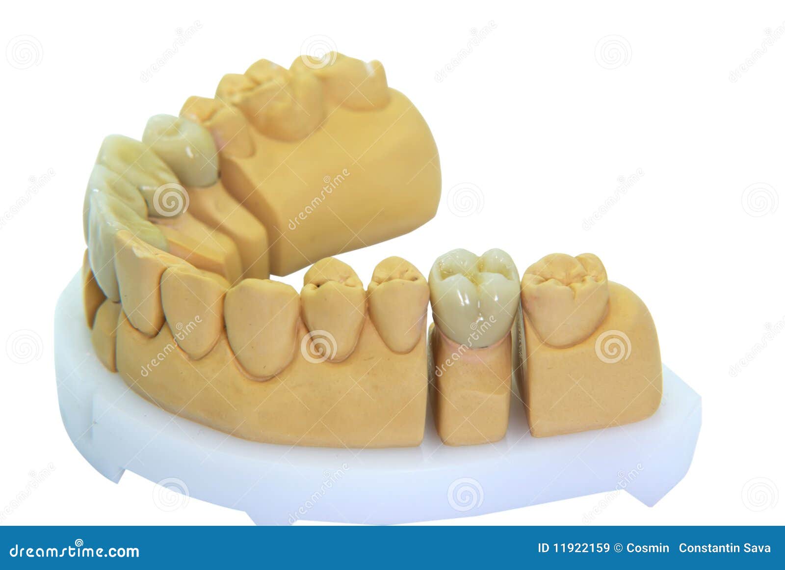 Porcelain Teeth On A Gypsum Model  Royalty Free Stock 