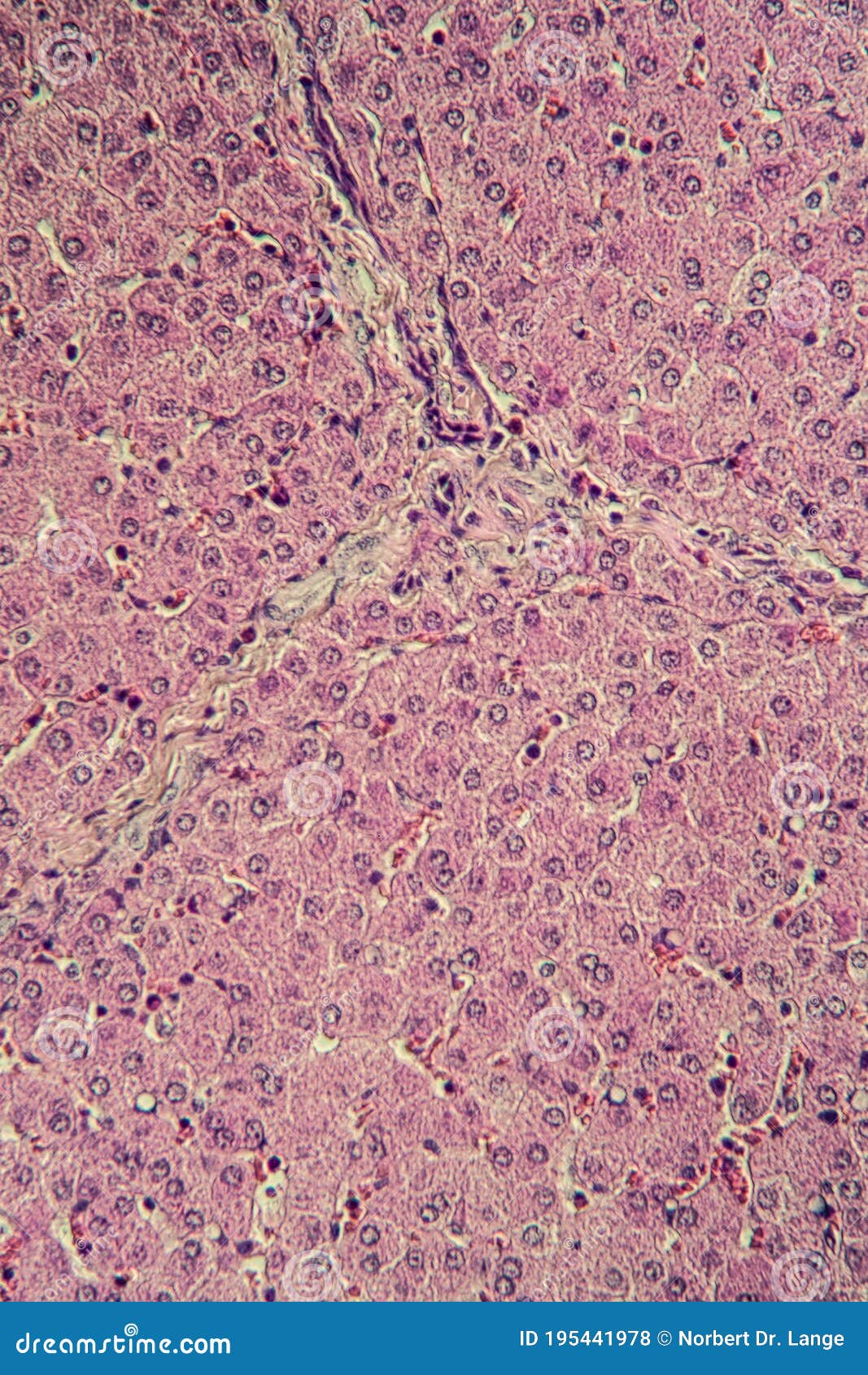 Pork liver tissue cut stock photo. Image of doctor, science 195441978