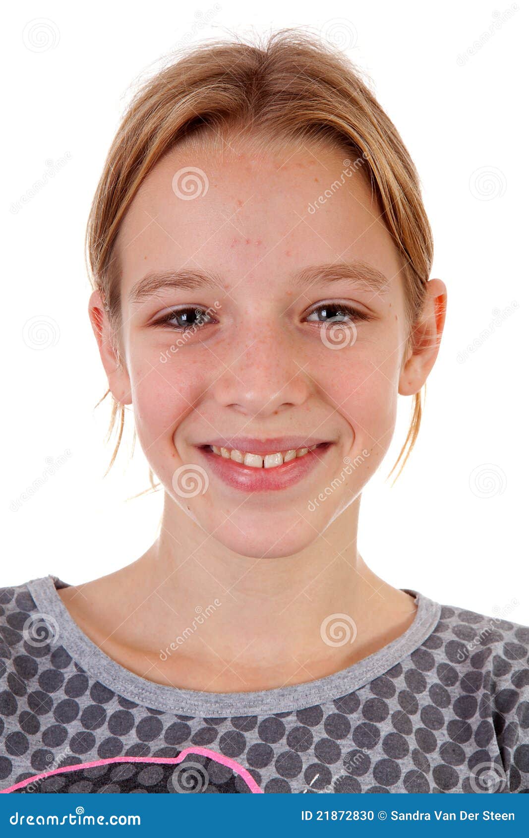 portait of teenage girl with pimpels