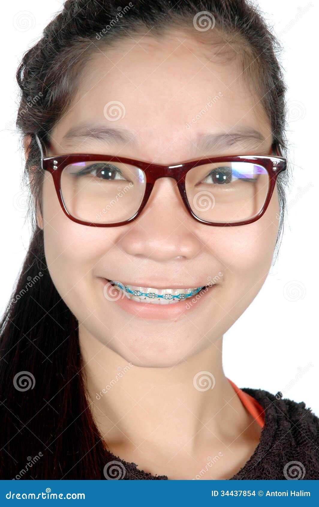 Portrait Of Asian Young Girl With Glasses And Braces Stock Pho