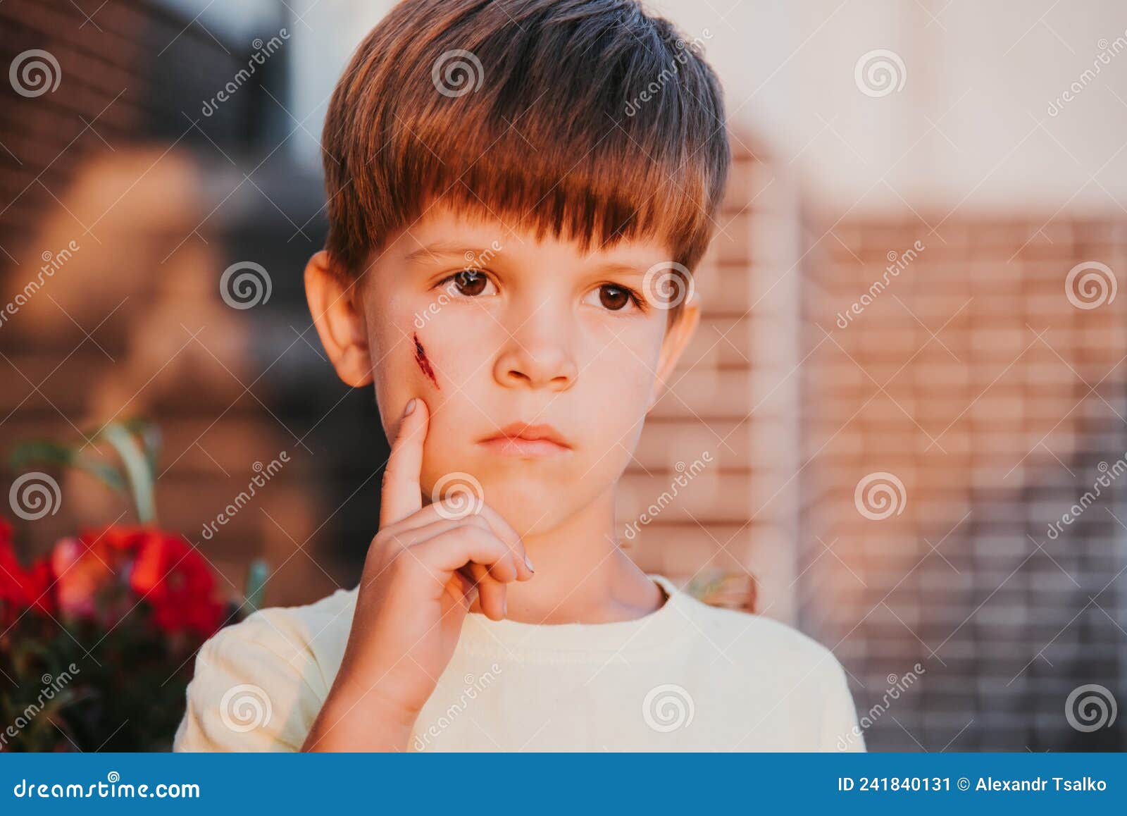 Portrait of a Cute Boy with a Scar on His Face Stock Image Image of