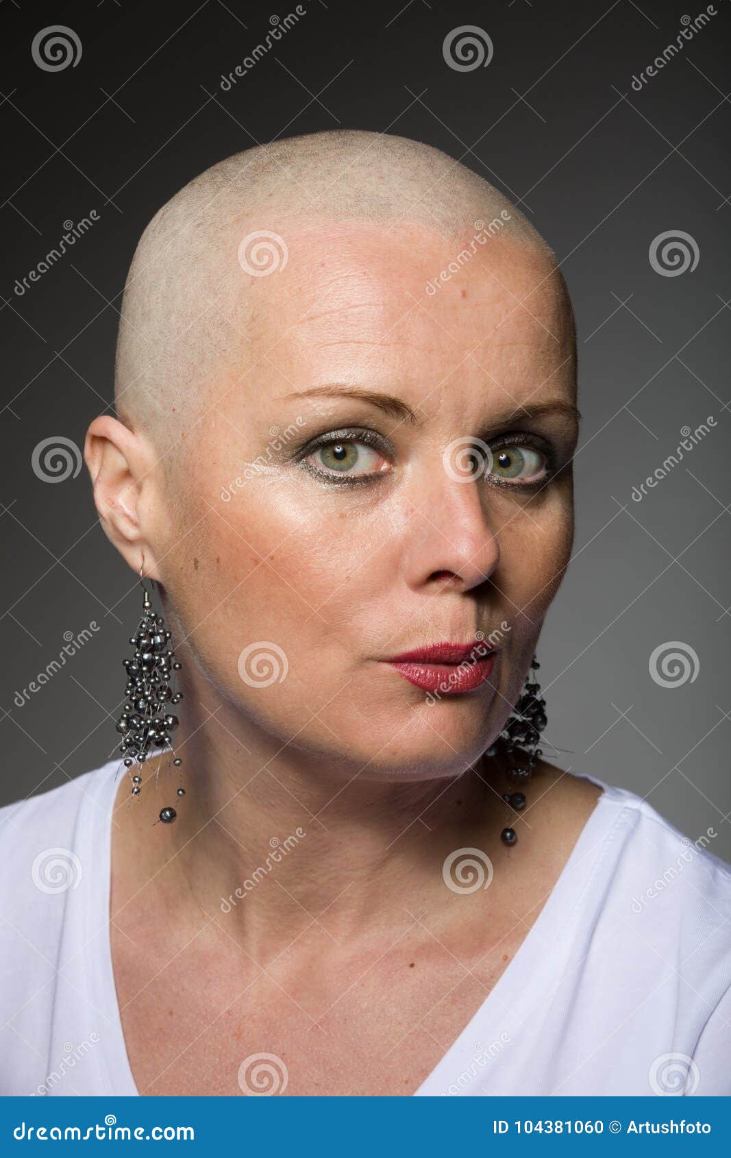 Beautiful Woman Cancer Patient without Hair Stock Photo - Image of face,  hair: 104381060