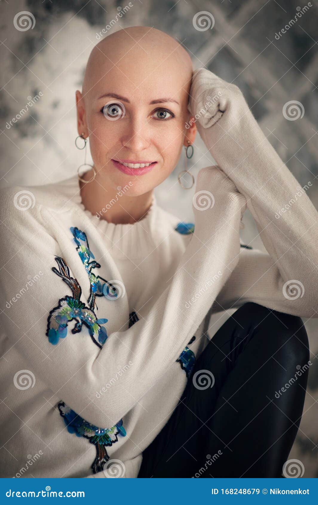 Portrait of Beautiful Middle Woman Patient with Cancer with Shaved Head  without Hair. Emotions, Hope in the Eyes Stock Image - Image of hair,  stage: 168248679