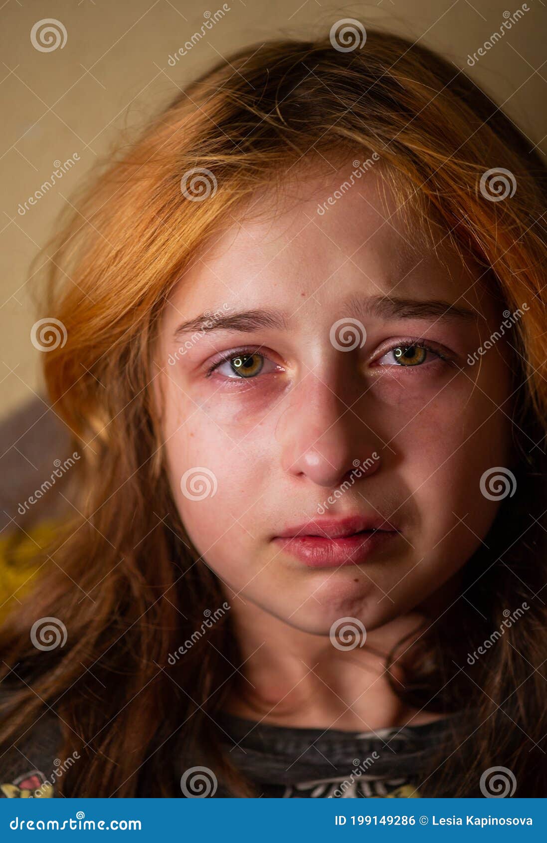 Portrait of Little Girl Crying with Tears Rolling Down Her Cheeks ...