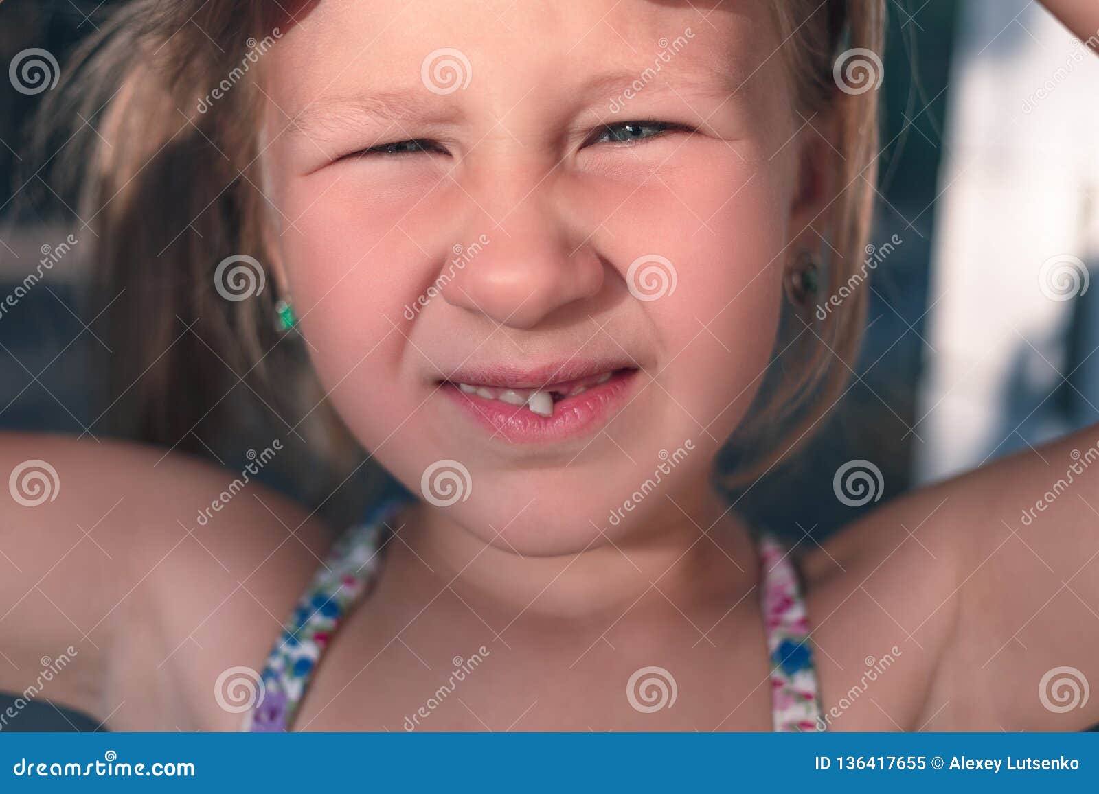 Portrait Of A Little Girl With A Wobbly Baby Tooth Stock Image Image