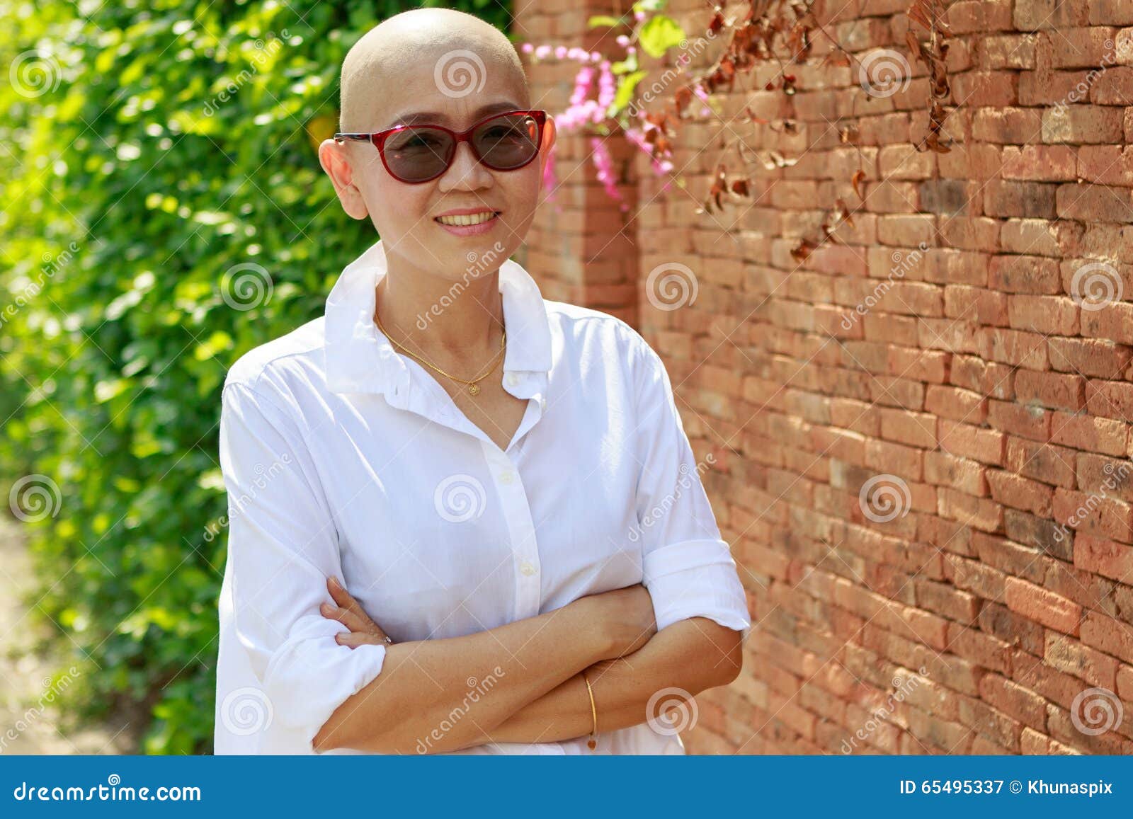 Asian Bald 2