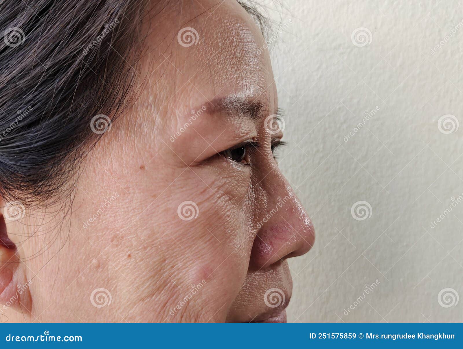 The Flabby Sagging And Dullness On The Face Stock Image Image Of