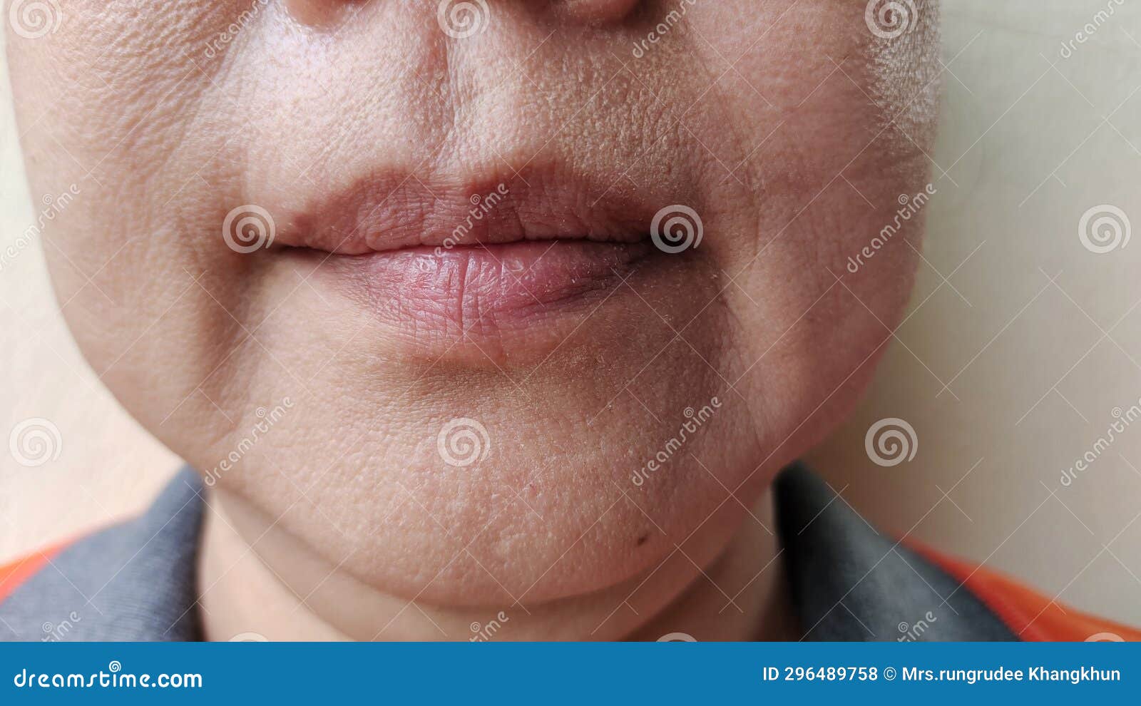 the flabby and wrinkles beside the mouth, problem blemishes and dark spots on the face.
