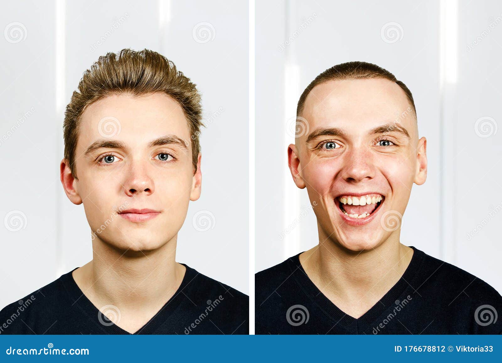 portrait of young man before arter haircut with hair loss: bald and pompadour, transplant and transformation