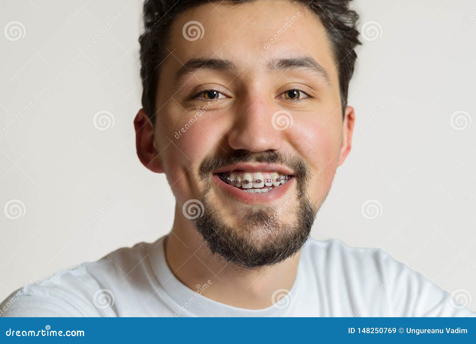 Portrait Of A Young Man With Braces Smiling. A Happy Young Man With