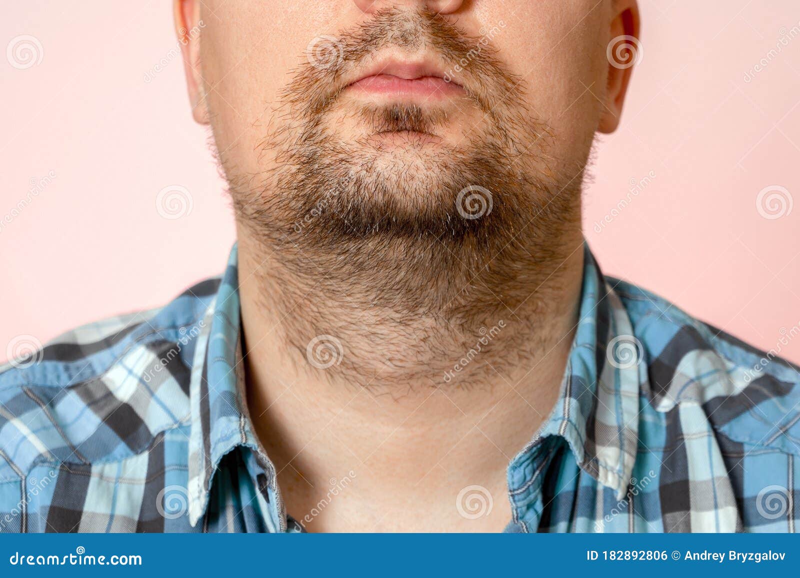 Portrait of Young Man with Unformed, Untrimmed, Overgrown Stubble. Hair on  Face and Neck Stock Photo - Image of skincare, overgrown: 182892806