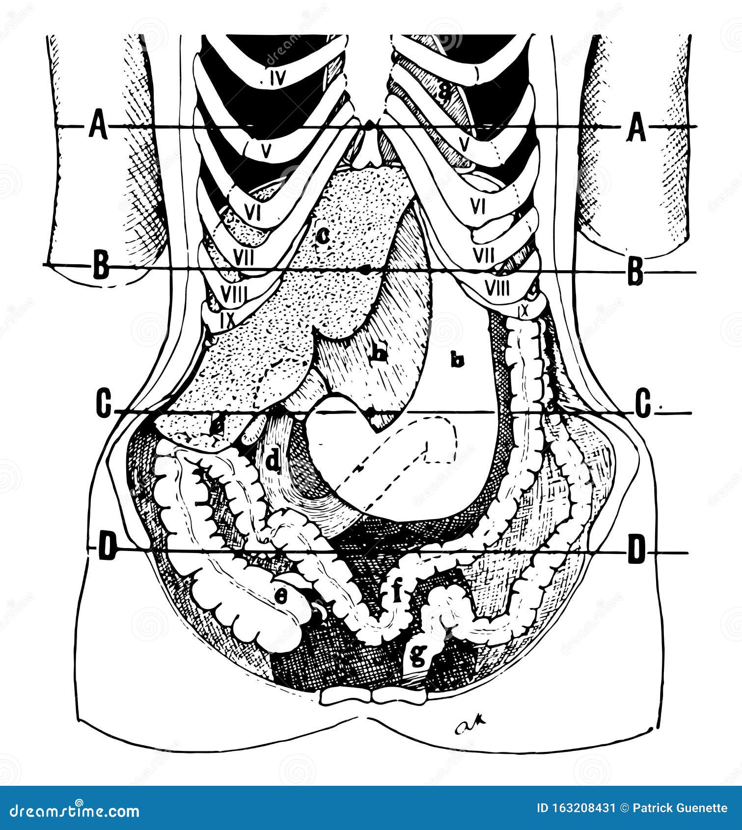 position of the viscera in the condition of visceroptosis, vintage 
