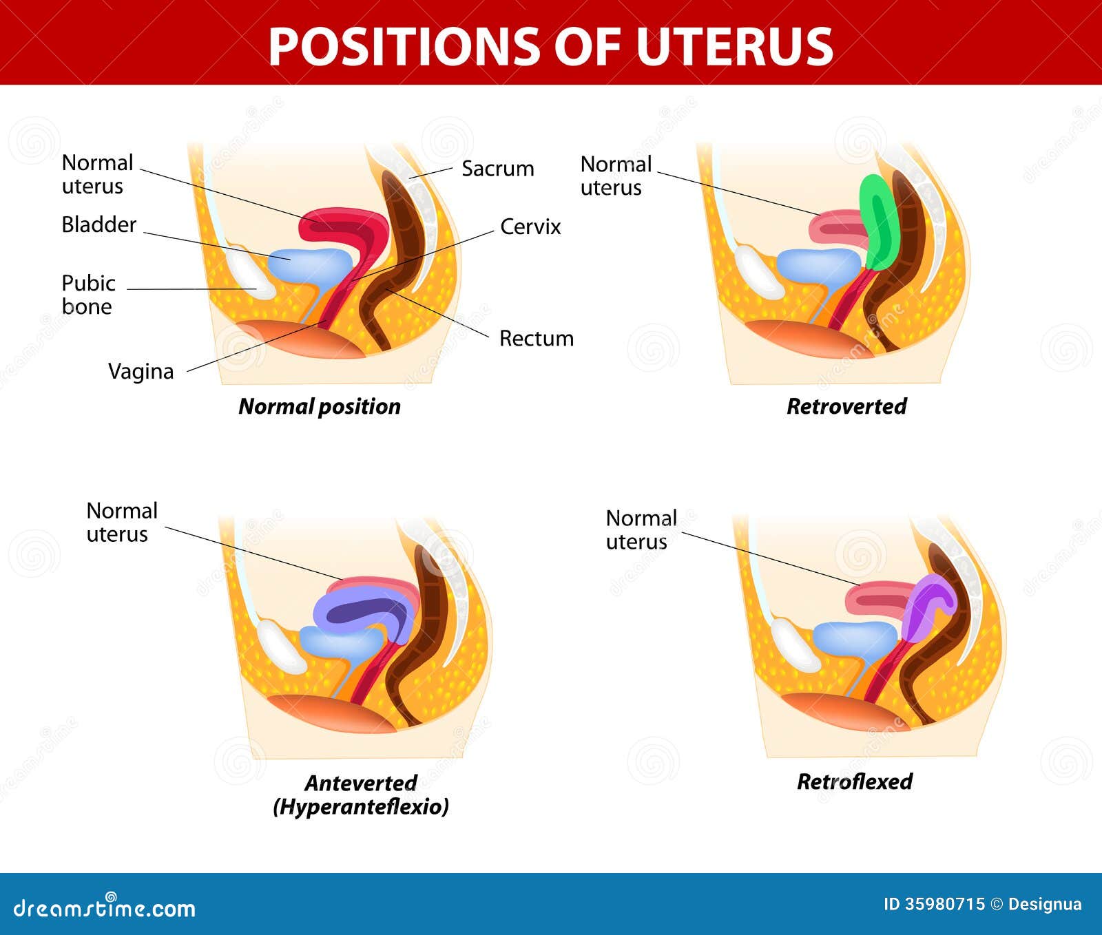 positions of uterus