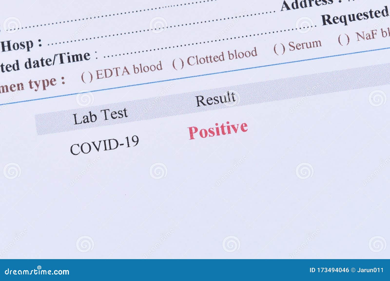 Positive Test Result Of Covid 19 Stock Photo Image Of Disease