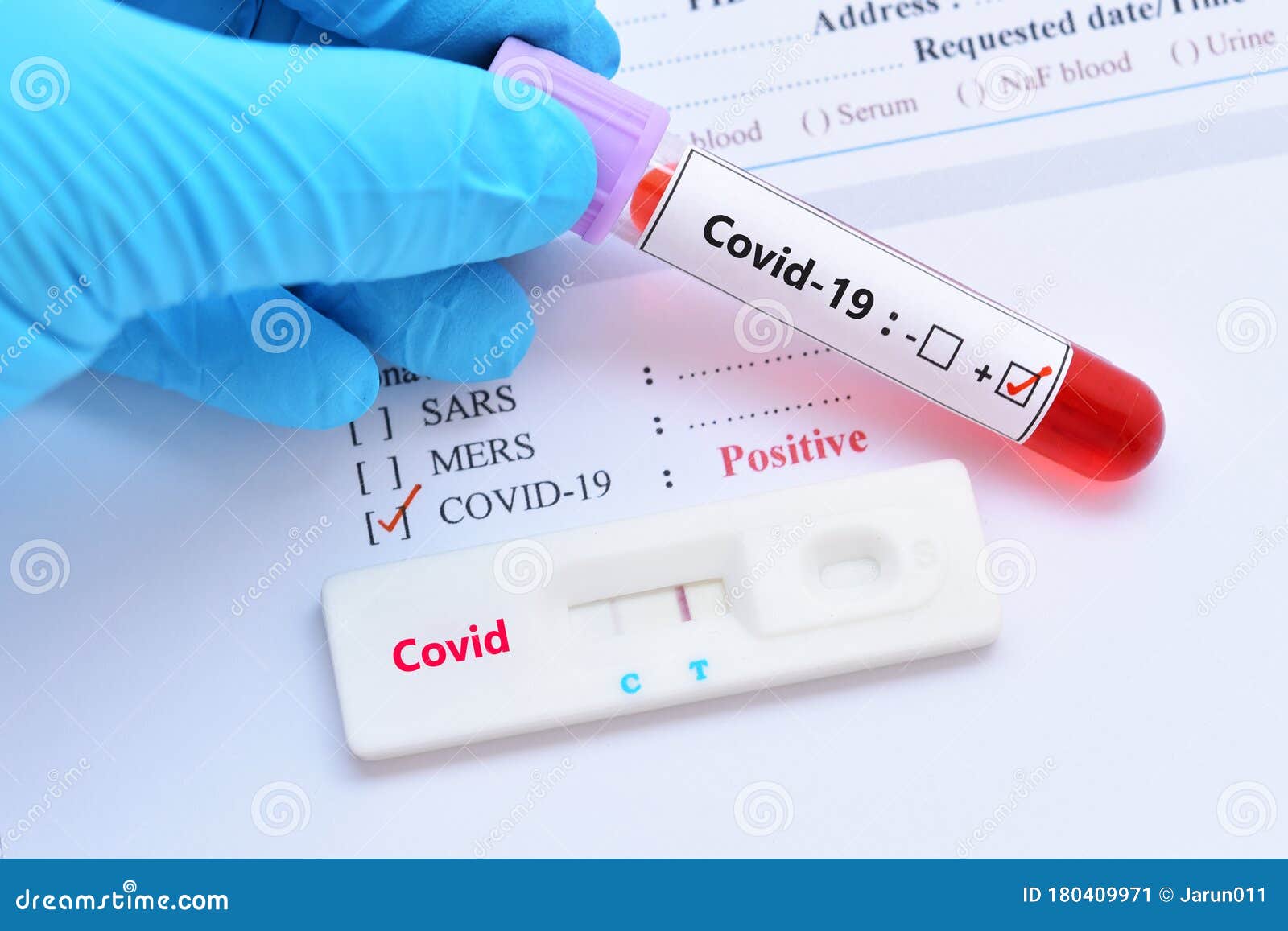 Positive Test Result By Using Rapid Test Device For COVID ...