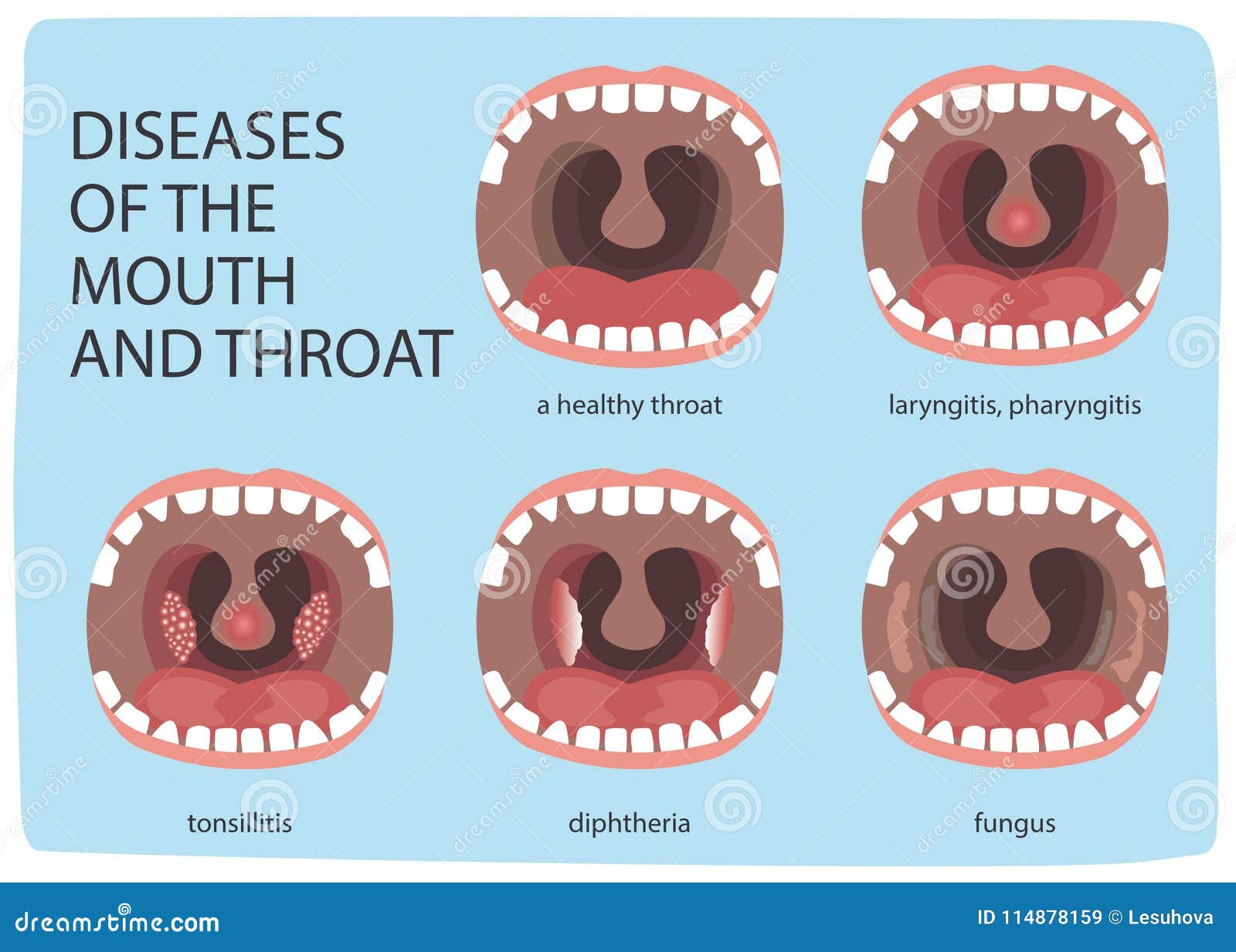 Normal Throat