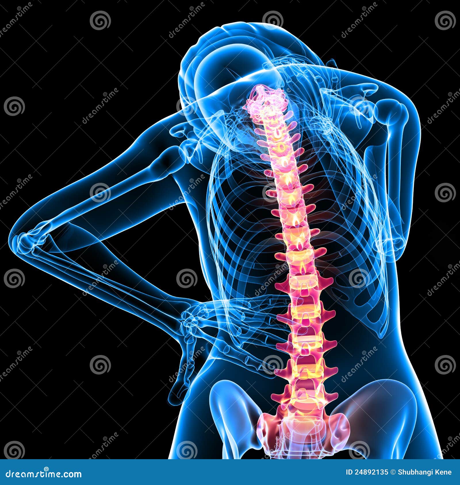 Posterior View Of Female Skeleton With Back Pain Stock Illustration