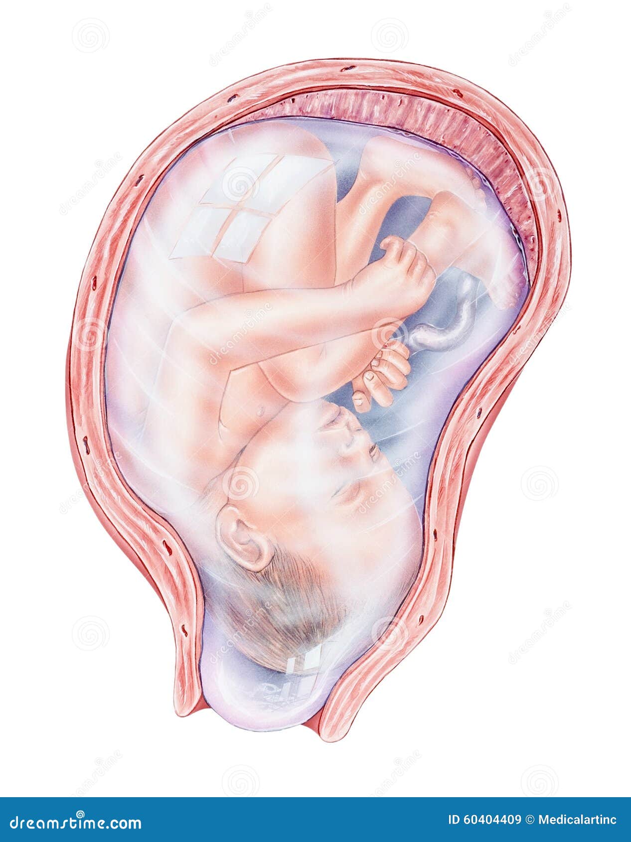 The Amniotic Sac is a fluid-filled membrane that surrounds and encloses the  developing fetus. It consists of two layers: the inner amnion... | Instagram