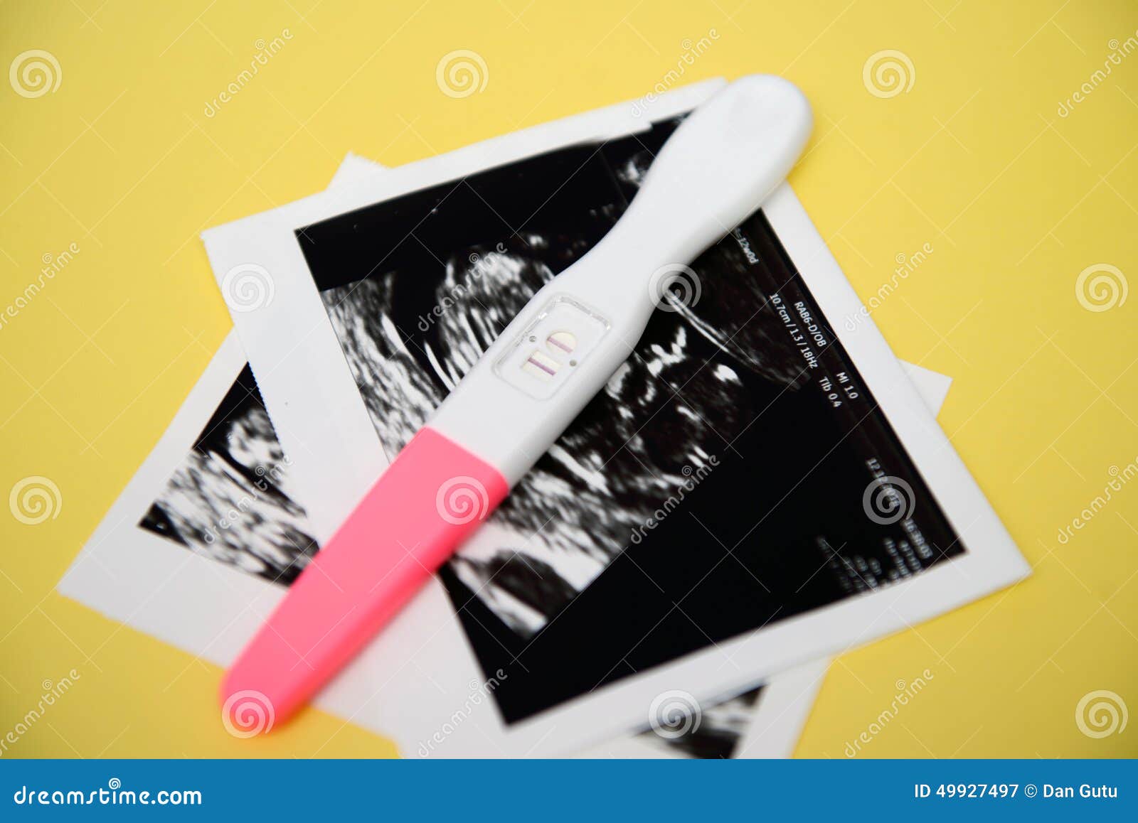 Pregnancy test stock image. Image of health, equipment 49927497