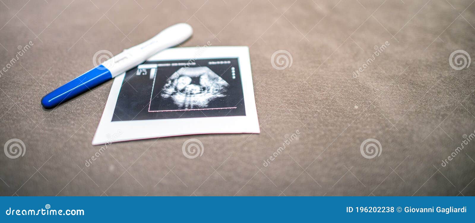 Pregnancy Test Stick And Fetus Ultrasound On The Table Stock Photo