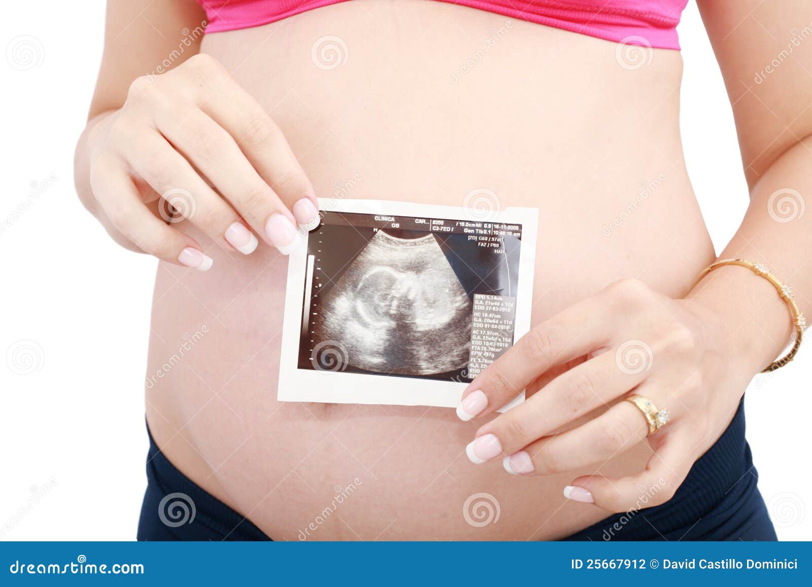 Diagram Pregnant Womans Body