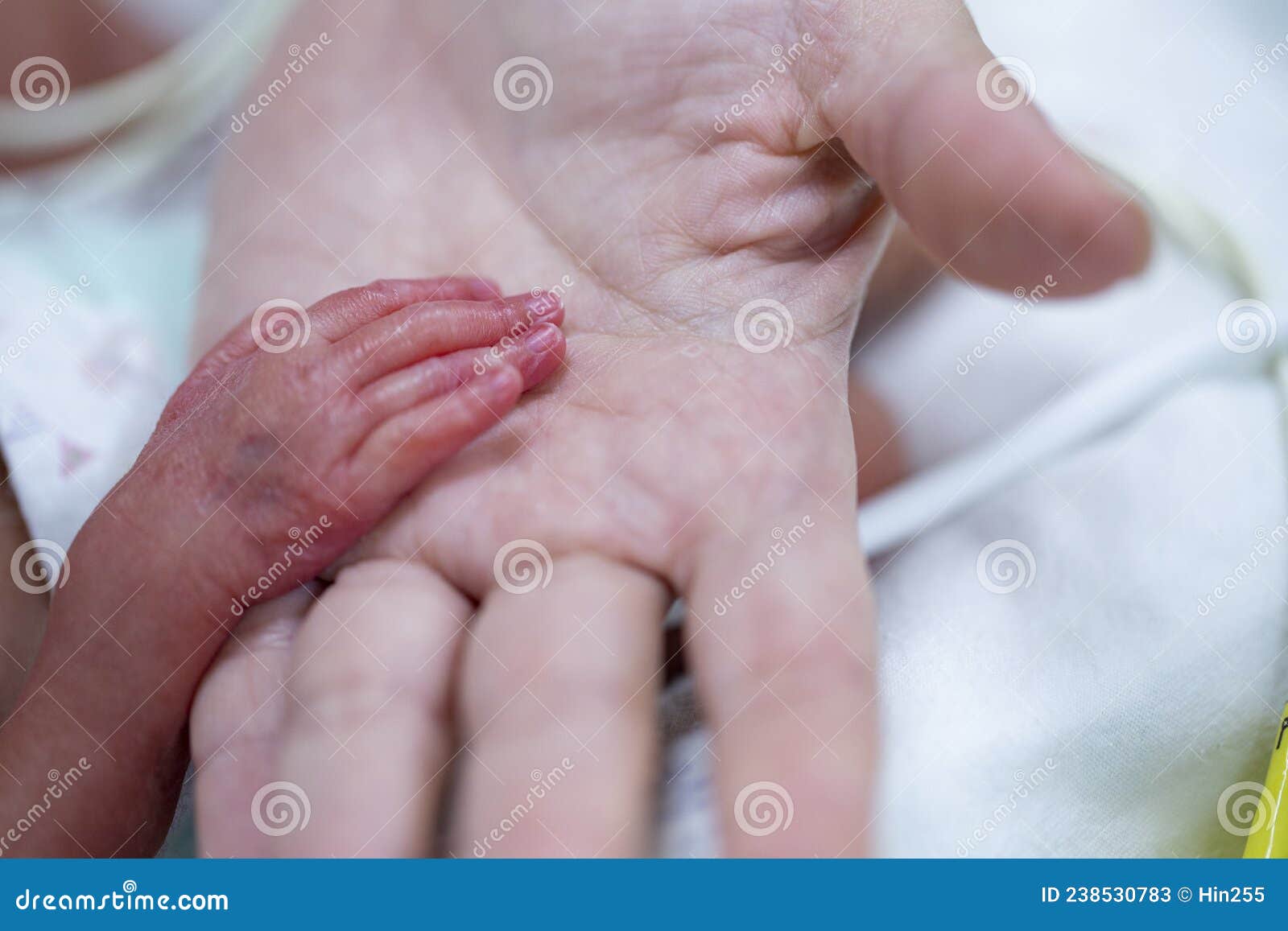 premature baby in hand