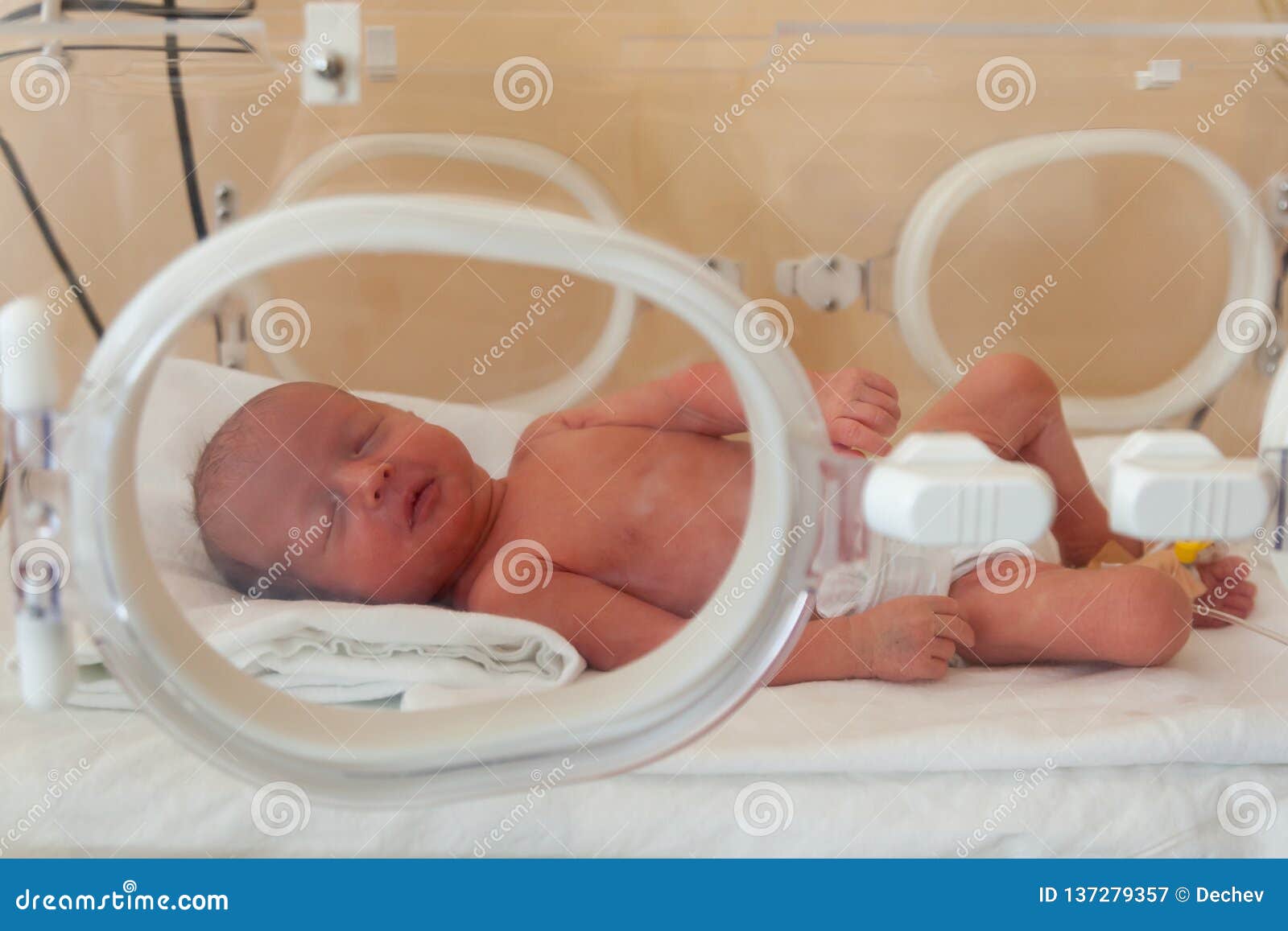 premature baby in incubator