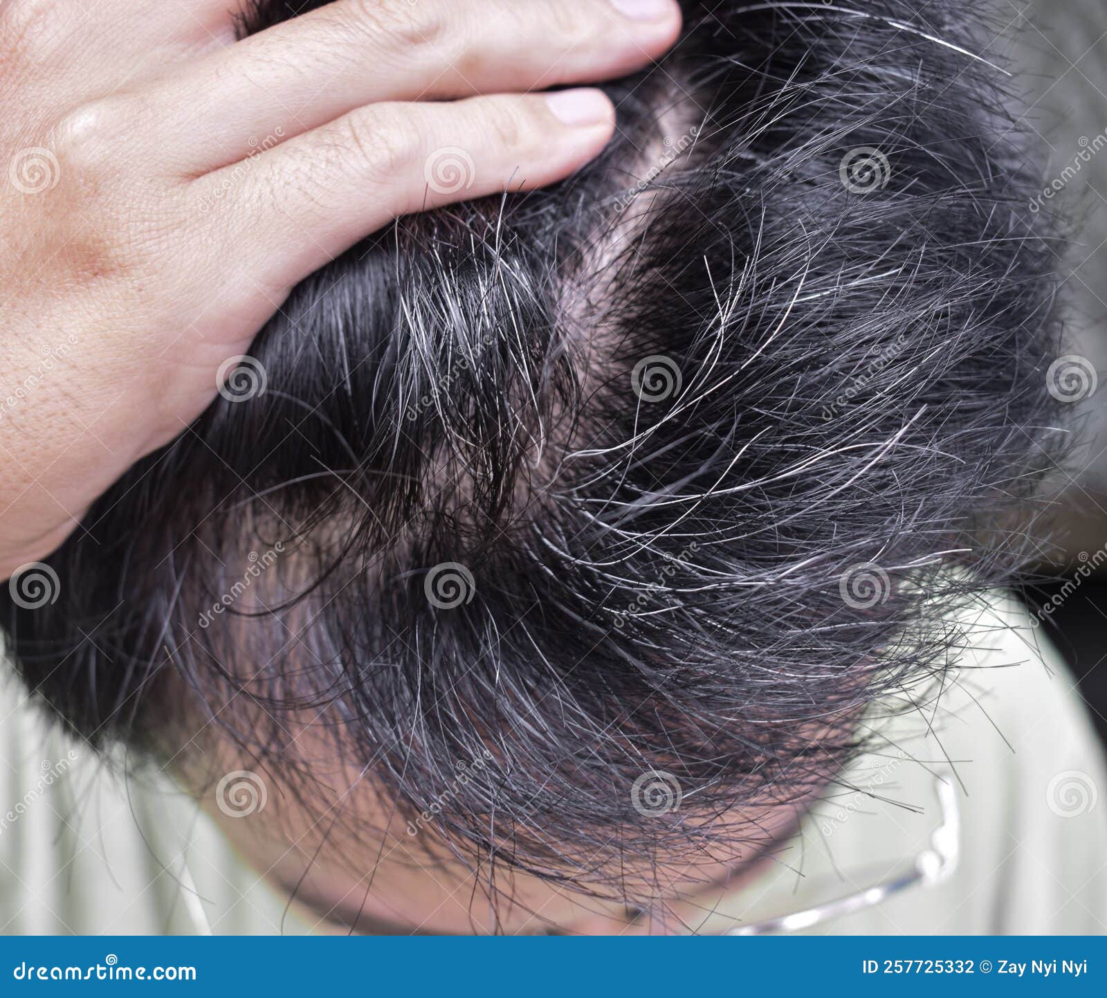 Gray Hair Premature Stock Photos - Free & Royalty-Free Stock Photos from Dreamstime Gray Hair Premature Stock Photos - Free & Royalty-Free Stock Photos from Dreamstime