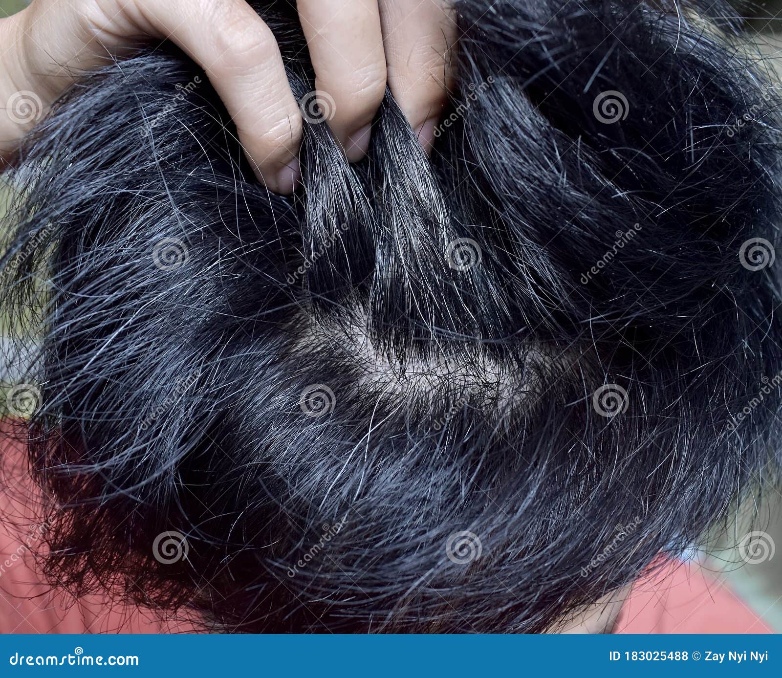 Prematurely Gray Hair. Southeast Asian Young Man Showing His Early Grey Hair  Stock Photo - Image of premature, asian: 183025488