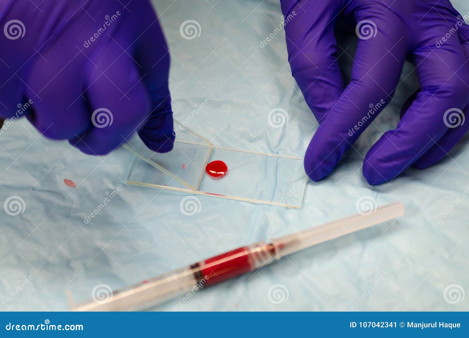 Для диагностики малярии забор крови осуществляют. Мазки крови. Исследование мазка крови. Мазок крови на предметном стекле.