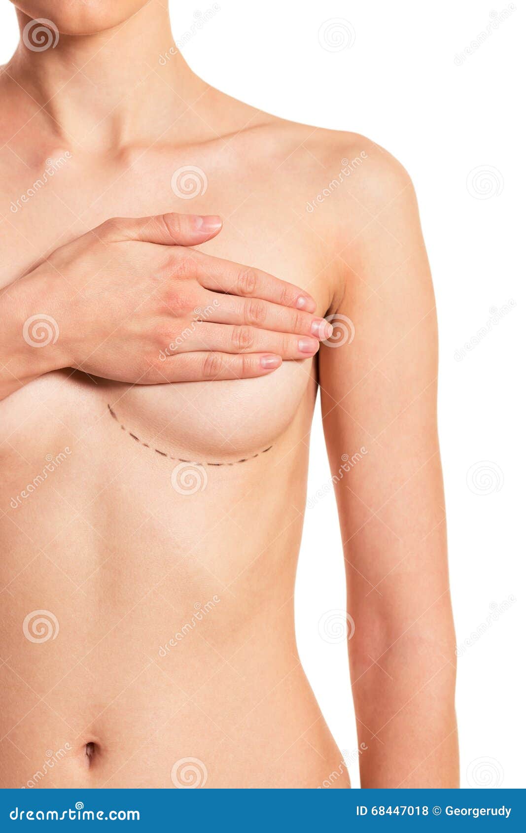 Breast enlarge surgery - Nude pics