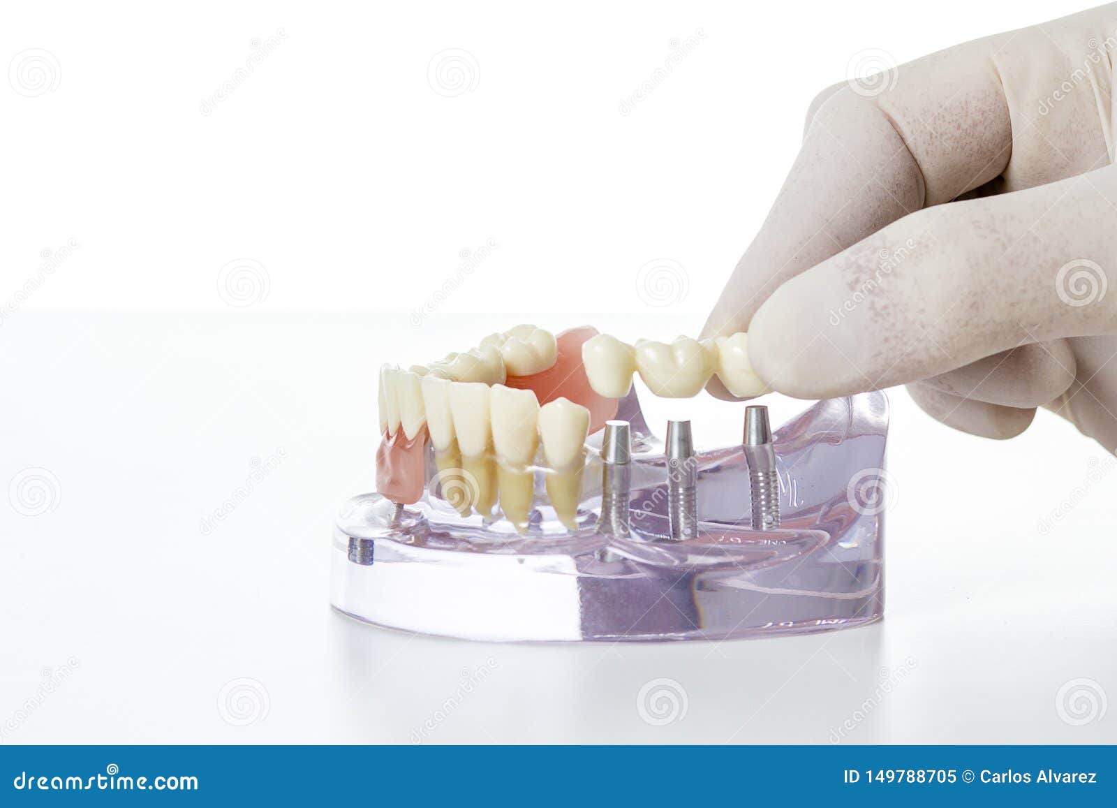 Preparation of Dental Prosthesis Stock Image Image of porcelain