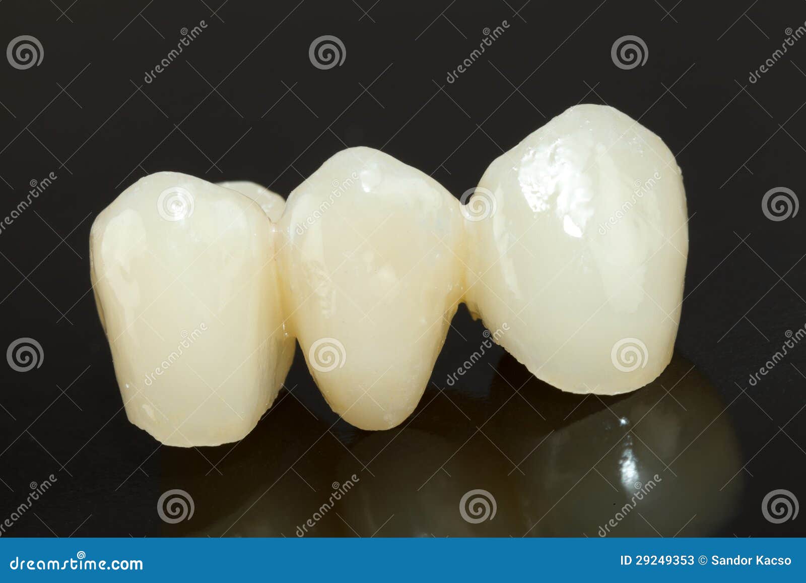 Pressed ceramic teeth stock image. Image of tooth, dental 29249353