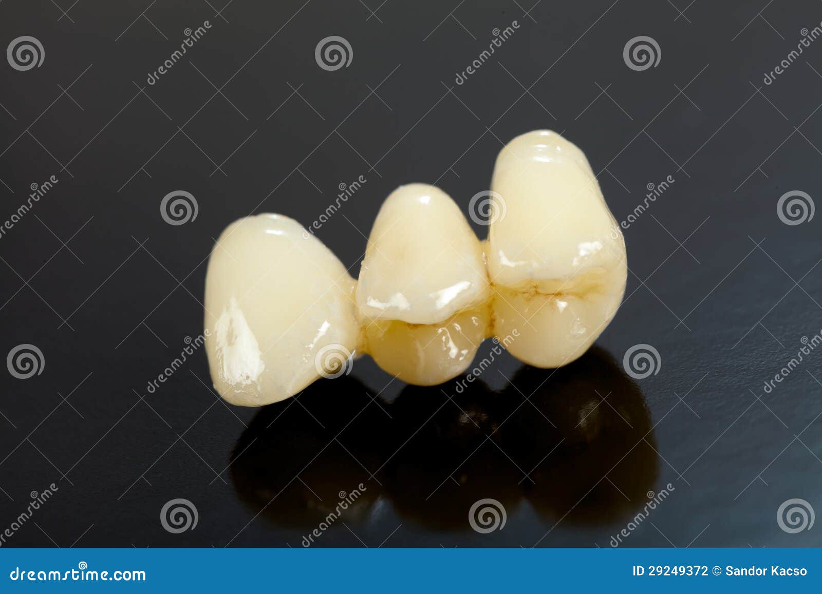 Pressed ceramic teeth stock photo. Image of teeth, products 29249372