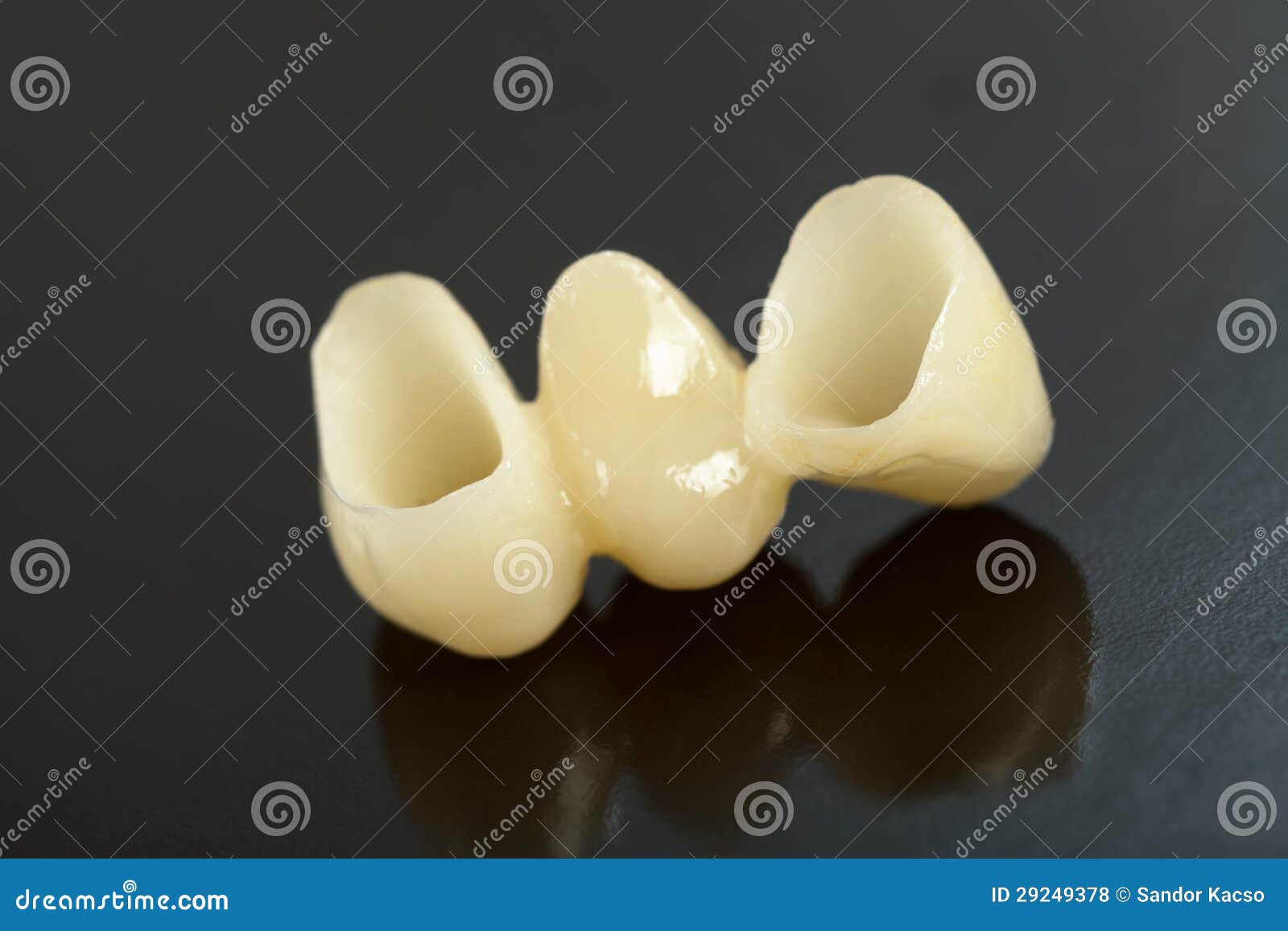 Pressed ceramic teeth stock photo. Image of tooth, product 29249378