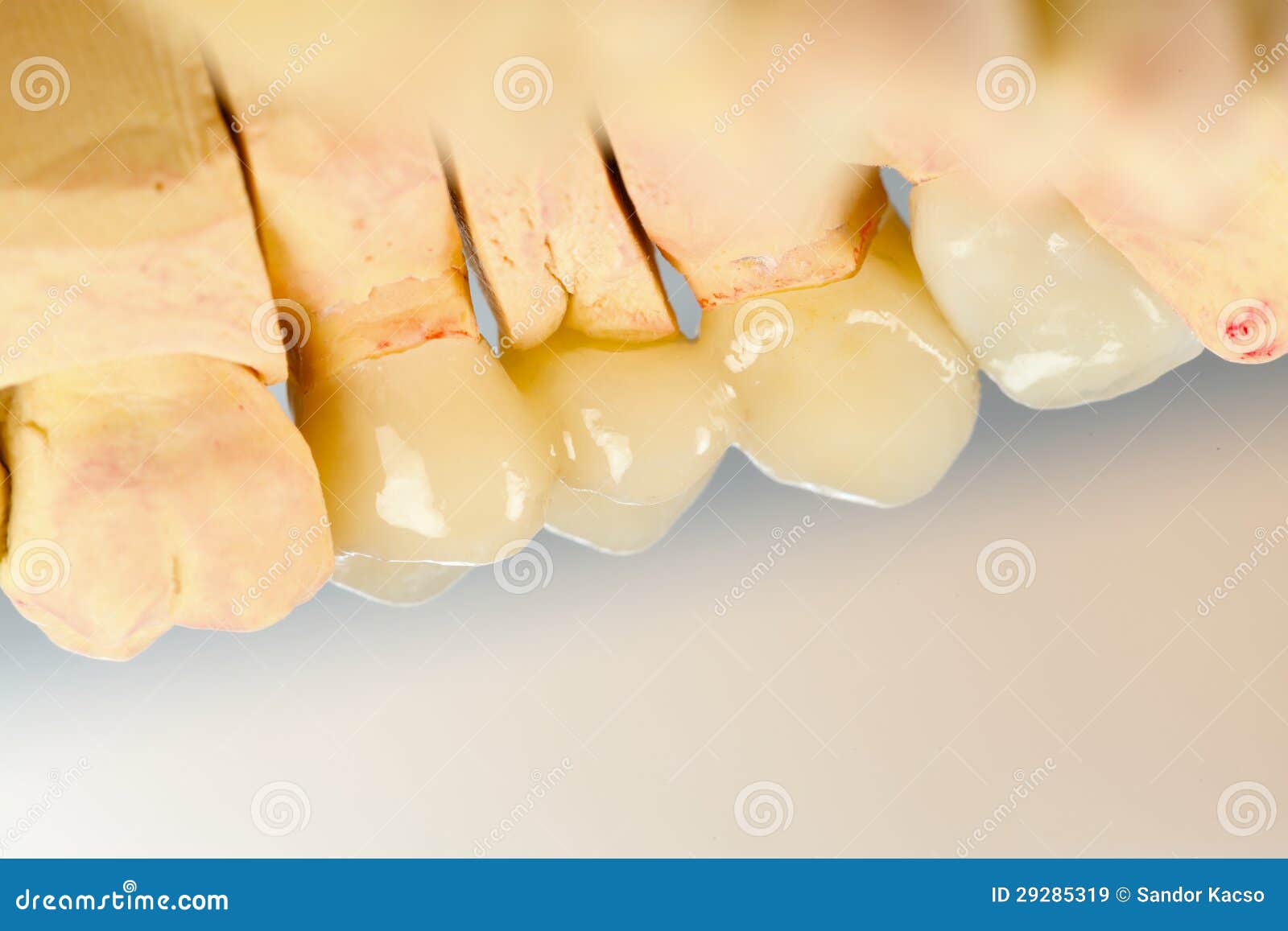 Pressed ceramic teeth stock image. Image of products 29285319